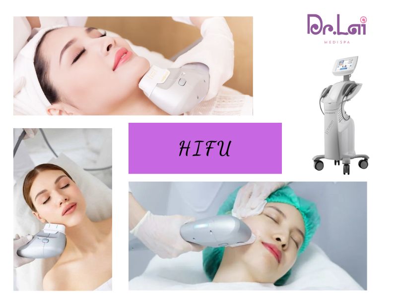Hiểu đúng về công nghệ làm đẹp da HIFU