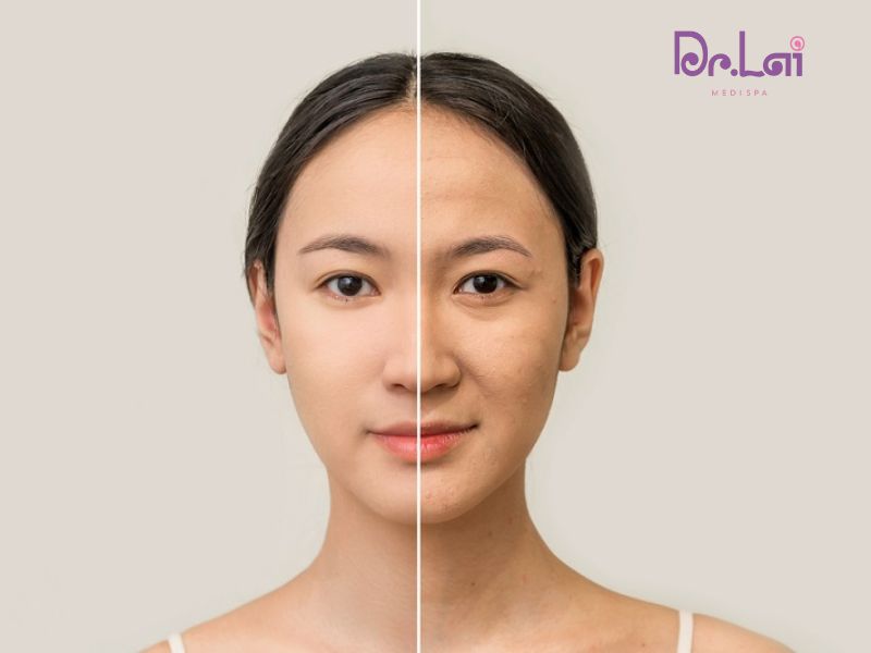 Những yếu tố quyết định "hiệu quả thật" của liệu trình HIFU