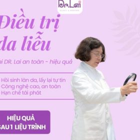 Cách trị mụn trứng cá ở trán an toàn: Những điều bạn nên biết để da sớm sạch mụn